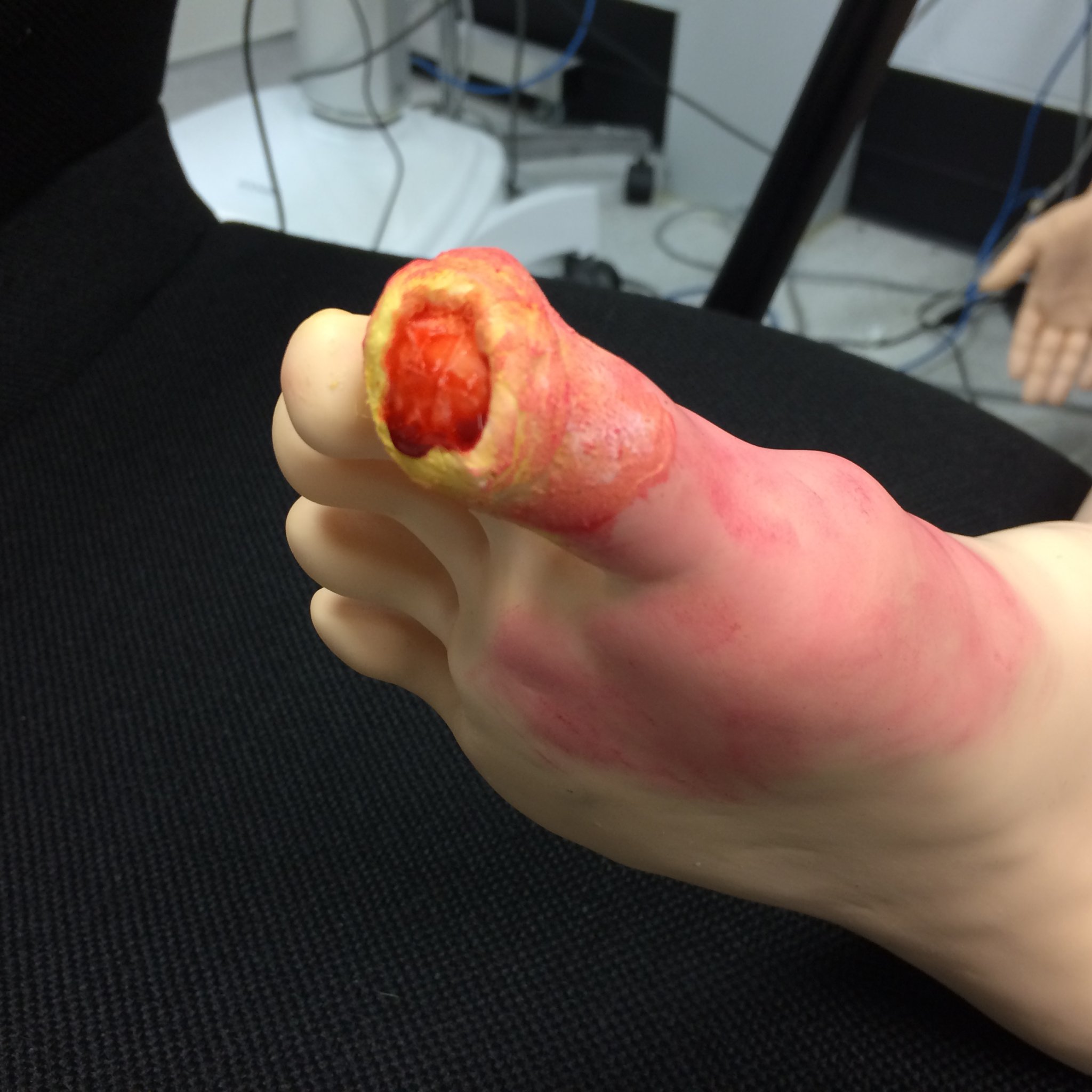 A mock toe injury, close up to show detail. 